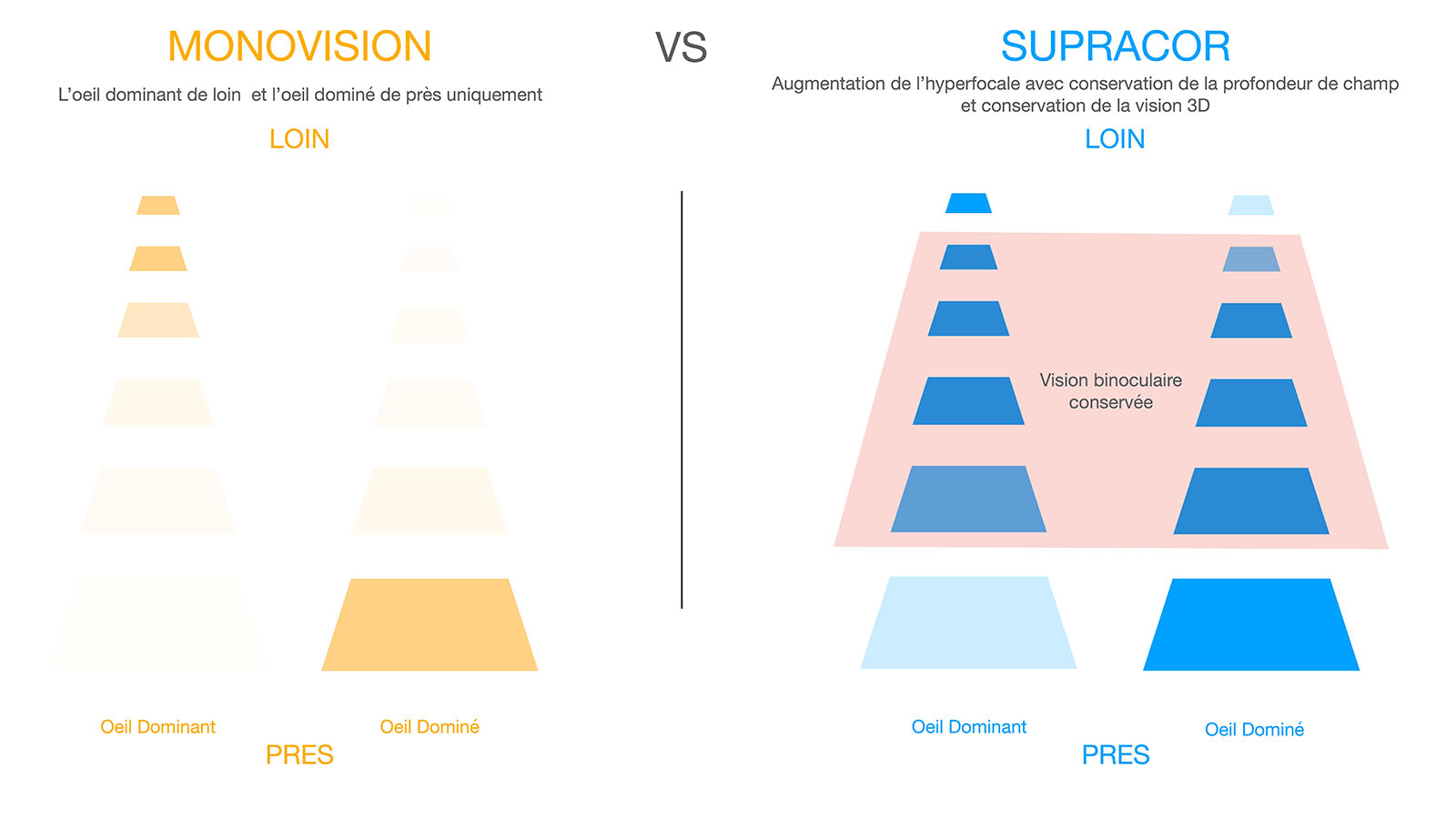 Schematic comparison of Monovision / Supracor techniques and their impact on vision for the dominant and dominated eye.